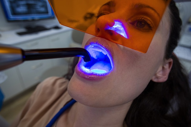 Dentistas examinando paciente femenino con luz de polimerización dental