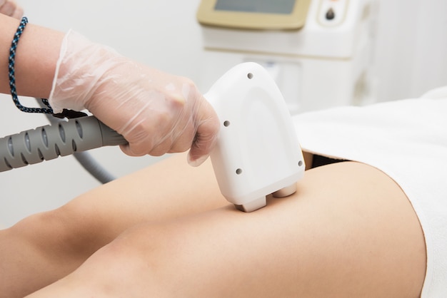 Depilacion laser de piernas