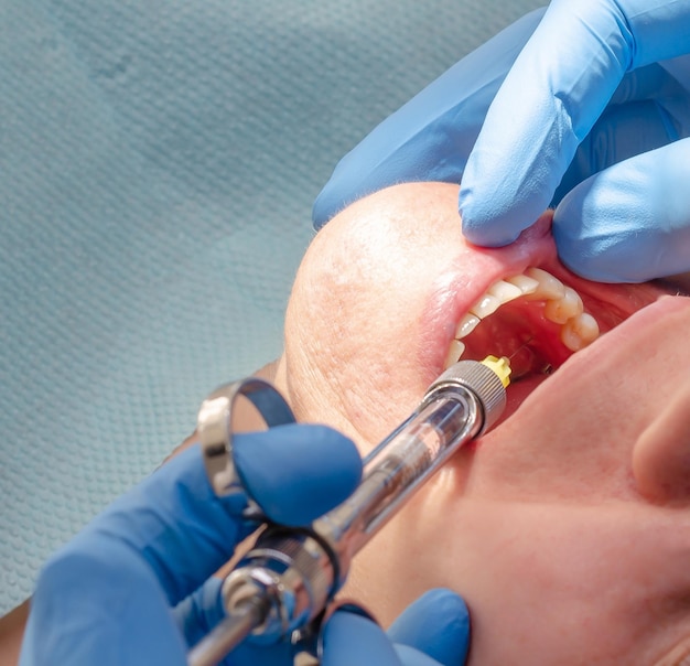 Der Arzt gibt dem Patienten in der Zahnklinik eine Anästhetikum-Injektion