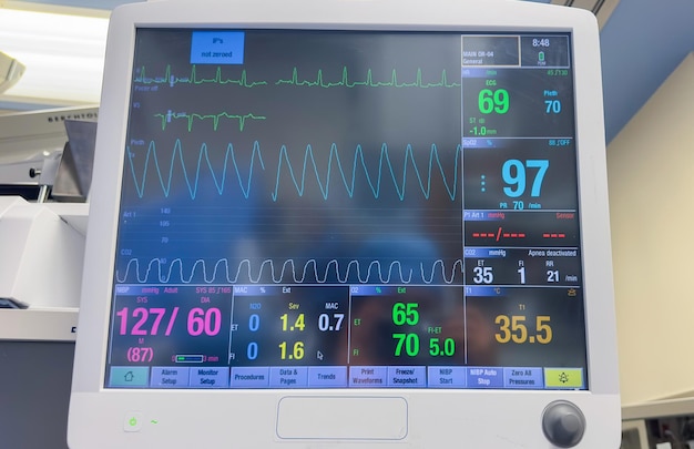 Der Krankenhausmonitor ist ein Symbol für die Vitalfunktionen des Gesundheitswesens und das Wohlbefinden des Patienten. Er überwacht den Blutdruck