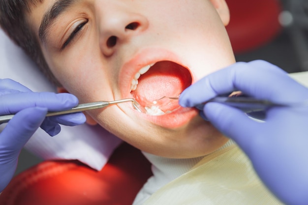 Der Zahnarzt im Büro behandelt die Zähne des Patienten, der sich auf dem Behandlungsstuhl befindet. Der Zahnarzt legt eine Zahnfüllung an