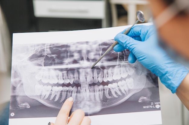 Der Zahnarzt zeigt dem Patienten ein Röntgenbild. Computerdiagnose. Zahntomographie