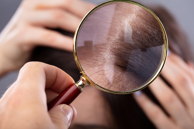 Dermatologista examinando o cabelo de uma mulher