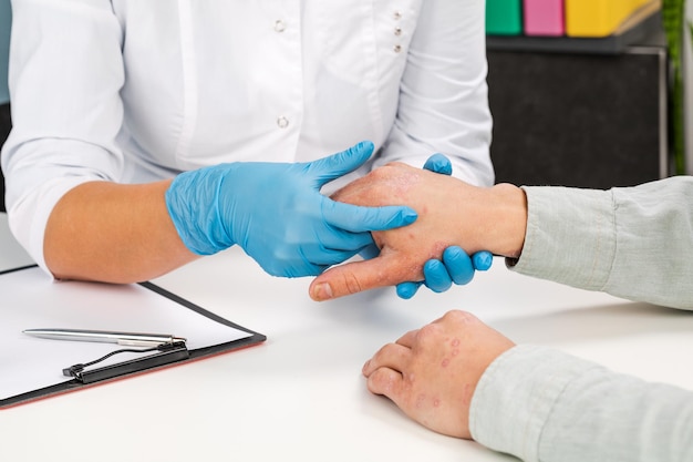 Foto un dermatólogo con guantes examina la piel de un paciente enfermo. examen y diagnóstico de enfermedades de la piel: alergias, psoriasis, eczema, dermatitis.