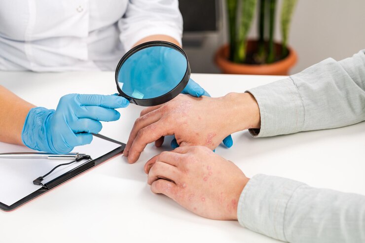 Foto un dermatólogo con guantes examina la piel de un paciente enfermo. examen y diagnóstico de enfermedades de la piel: alergias, psoriasis, eczema, dermatitis.