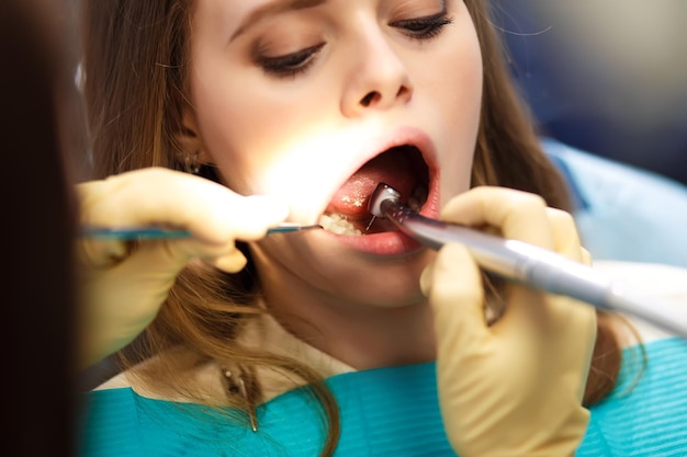 Descripción general de la prevención de la caries dental Mujer en la silla del dentista durante el procedimiento dental Sonrisa saludable