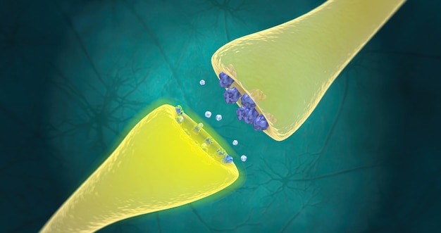 Un desequilibrio de neurotransmisores químicos cerebrales causa trastorno de ansiedad