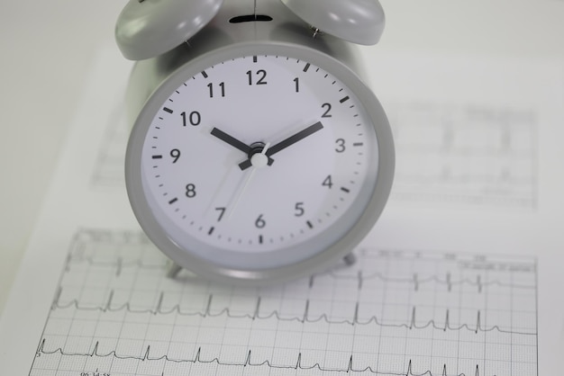 Despertador redondo fica em papéis de eletrocardiograma na mesa na frequência cardíaca profissional do hospital