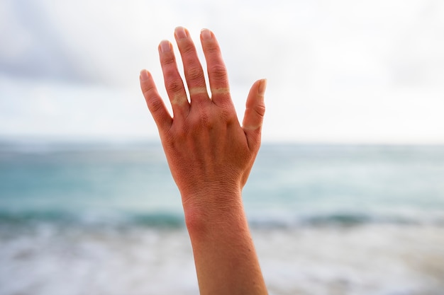 Foto details der sonnenbrandhaut einer frau von der strandsonne