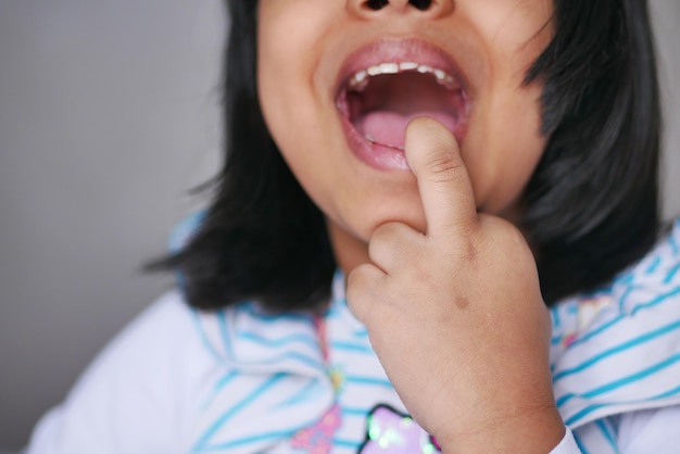 Detalle de una foto de un niño al que le faltan dientes