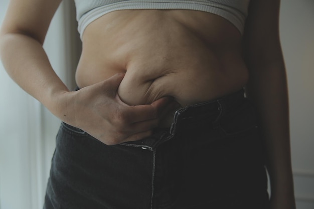 Dicke Frau dicker Bauch mollige fettleibige Frau Hand hält übermäßiges Bauchfett mit Maßband Frau Diät Lifestyle-Konzept