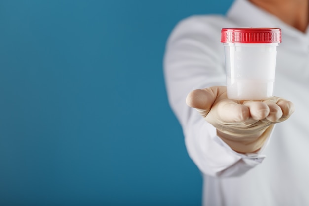 Die behandschuhte Hand eines Arztes hält eine Flasche eines Behälters mit einer Spermaprobe zur medizinischen Analyse