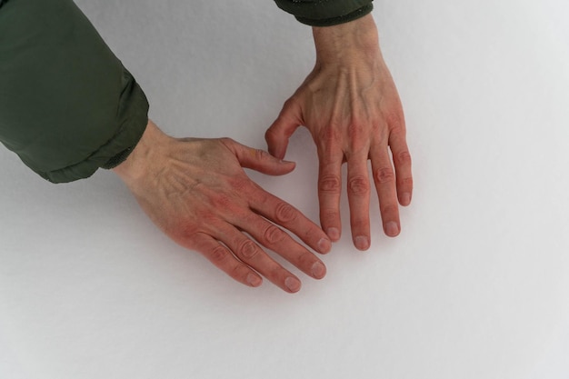 Die Hände des Mannes, die im Schnee rot wurden, zeigen Widerstandsfähigkeit und Immunität im Winter