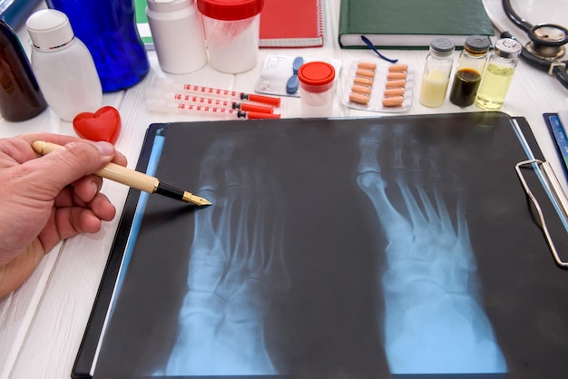 Die Hand des Arztes zeigt auf das Röntgenbild auf dem Tisch