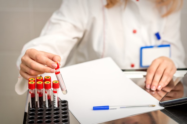 Die Hand eines Labortechnikers oder einer Krankenschwester nimmt ein leeres Blutreagenzglas aus dem Gestell im Forschungslabor