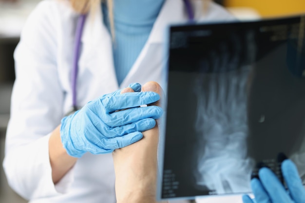 Die Ärztin untersucht das Röntgenbild der Beine des Patienten, Fußverletzungen und Verstauchungen