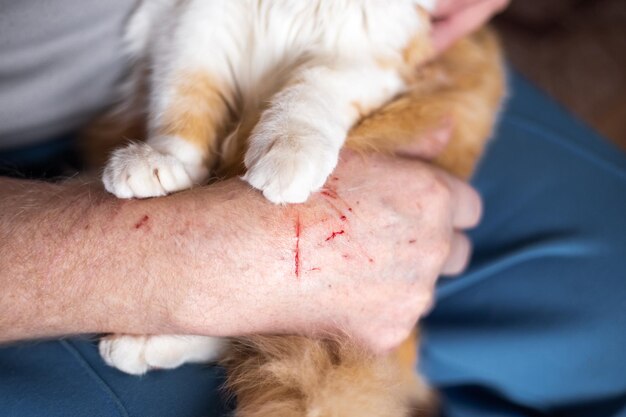 Die zerkratzte Hand des Haustierbesitzers und die Pfoten der Katze