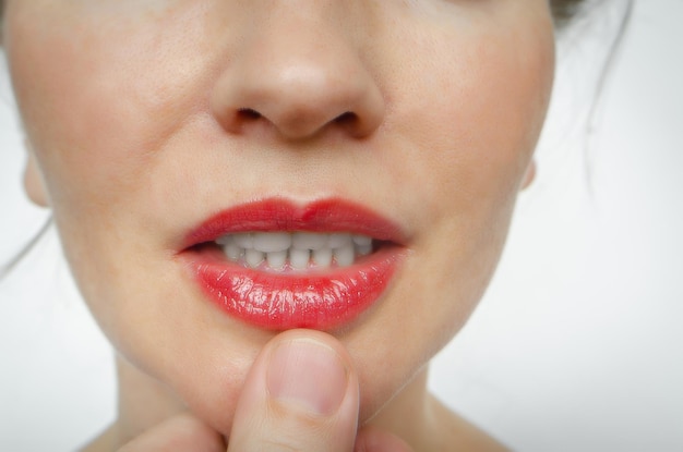 Dientes blancos de una mujer Tratamiento de Odontología