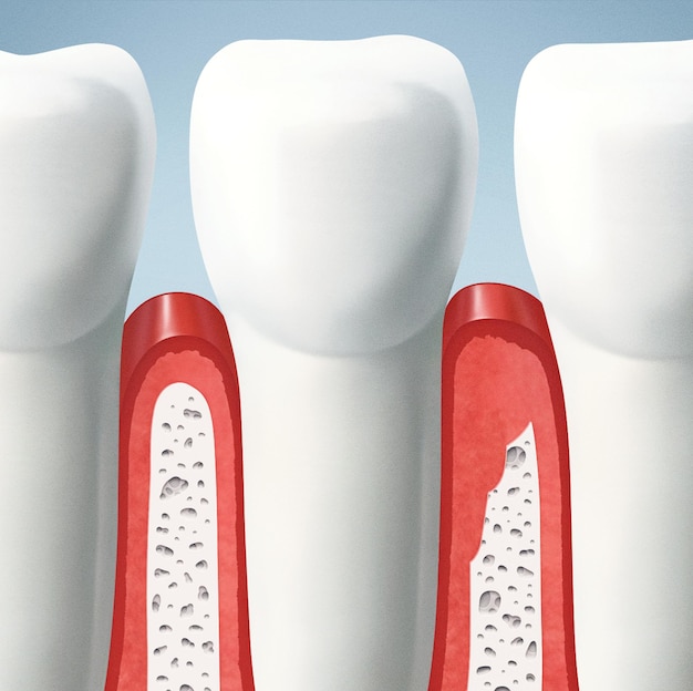 dientes y encías dientes y encías