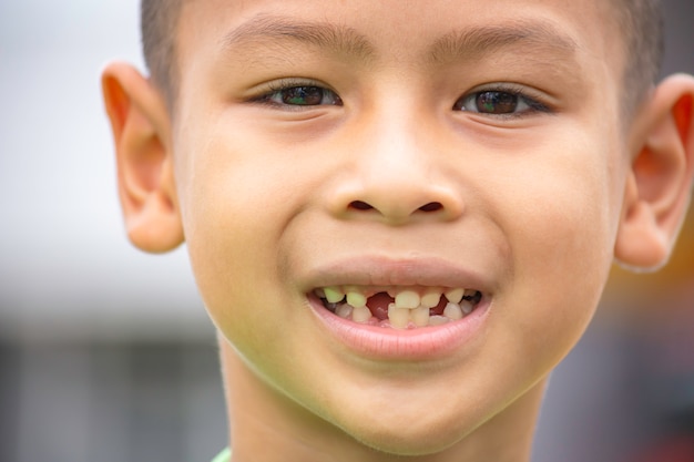 Foto los dientes de leche se dejan caer en la boca.