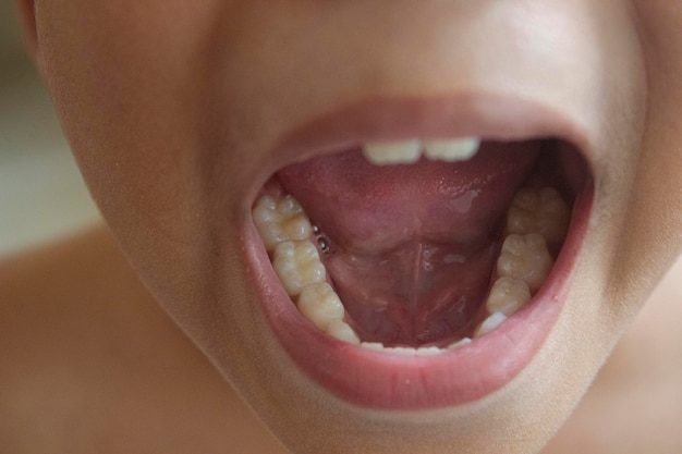 Los dientes de un niño en un primer plano extremo