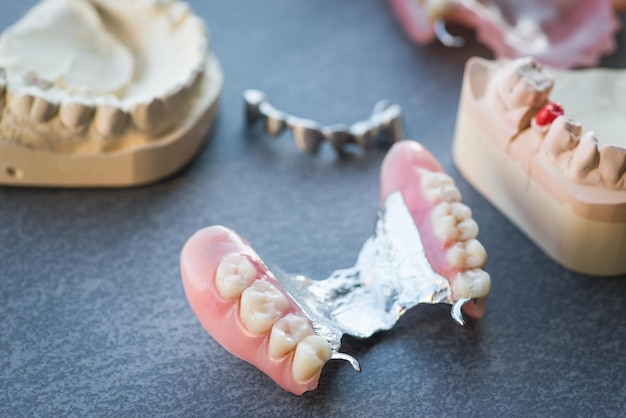 Foto dientes de reemplazo artificiales en una mesa oscura