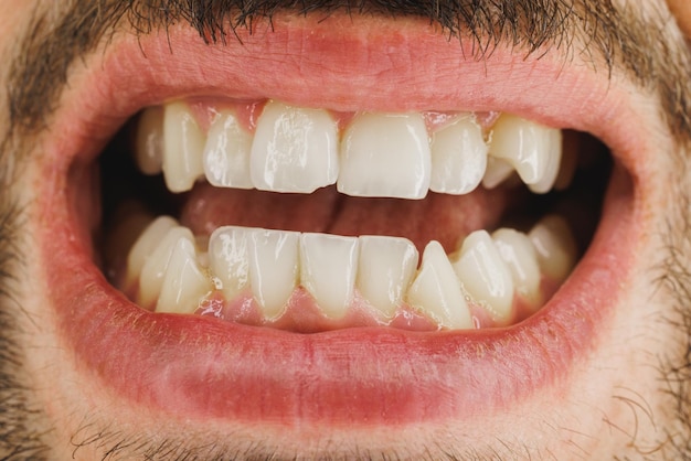 Disparo de un hombre irreconocible sonriendo con dientes antes de que le hicieran un ortodoncista o un trabajo dental.