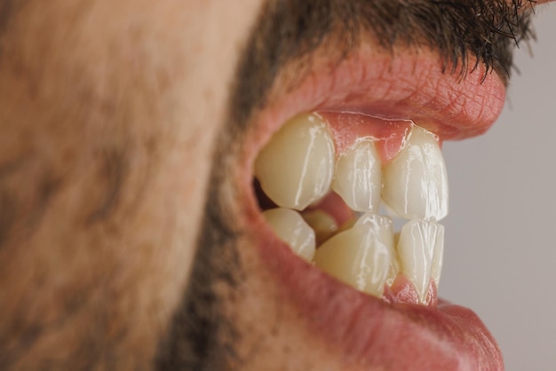 Disparo de un hombre irreconocible sonriendo con dientes antes de que le hicieran un ortodoncista o un trabajo dental.