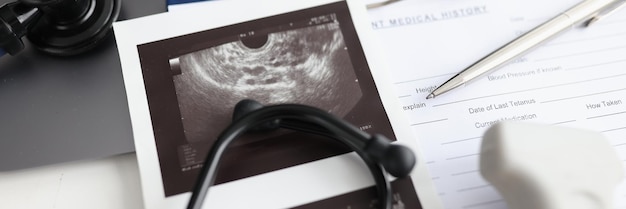Dispositivo de ultrassom moderno com sensor e ultrassom do útero