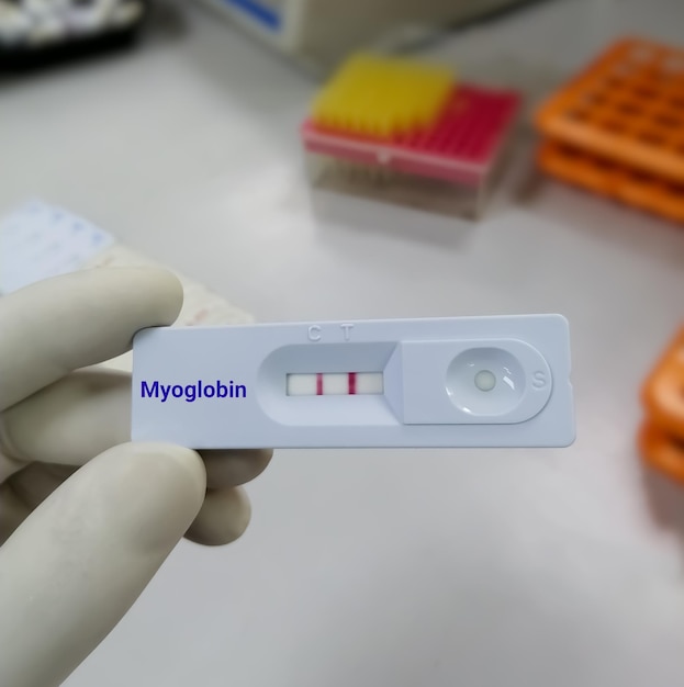 Dispositivo de prueba o casete para la prueba de mioglobina para el diagnóstico de infarto agudo de miocardio