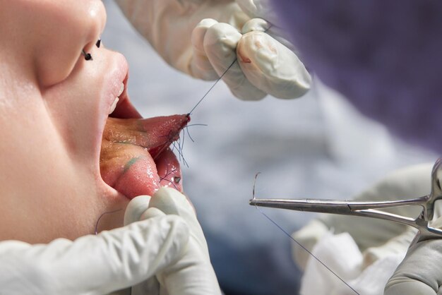 Foto división de la lengua cortando la lengua un tipo de modificación del concepto de cirugía del cuerpo humano