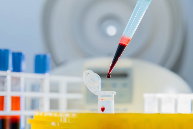 DNA-Test im Labor. Ein Tropfen Blut