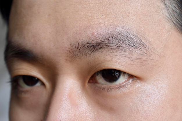 Dobras de pele envelhecidas ou vincos de pele ou rugas no rosto, especialmente ao redor dos olhos do homem chinês do Sudeste Asiático