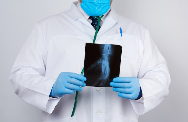 Doctor en bata blanca y guantes azules de látex sostiene una radiografía