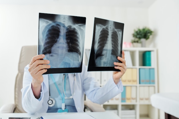 Doctor comparando radiografías de pulmones