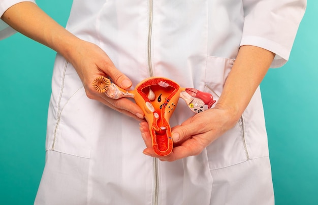 El doctor está sosteniendo los órganos reproductores femeninos modelo seccionales