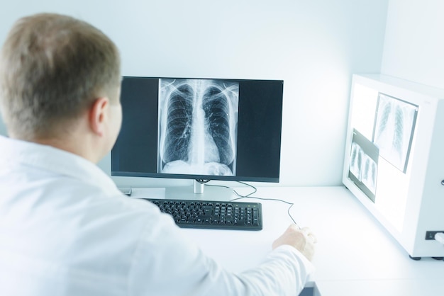 doctor, estudiar, radiografía, en, computadora