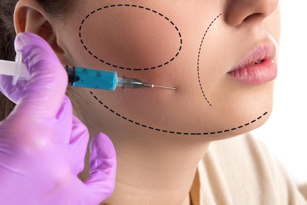 El doctor con guantes violetas está inyectando un botox con una aguja en la cara del paciente