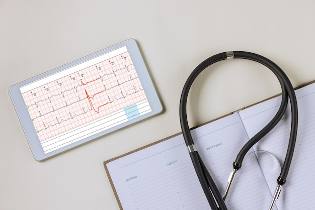Doctor en el lugar de trabajo con un estetoscopio electrocardiograma lecturas de frecuencia cardíaca en una mesa digital