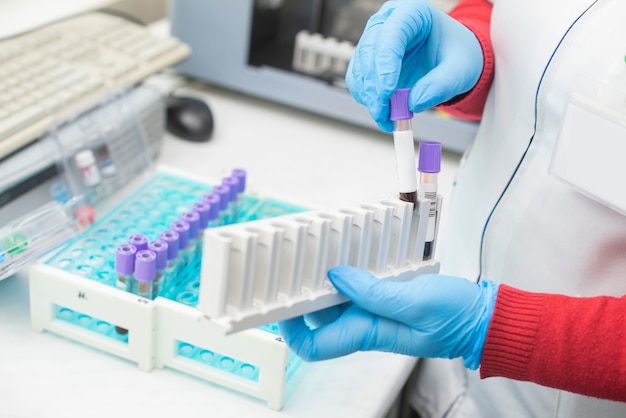 Doctor mano tomando un tubo de muestra de sangre en el laboratorio