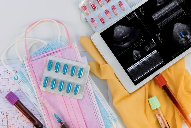 Doctor mesa de trabajo médica con estetoscopio en la investigación en ultrasonido d examen cardíaco de la