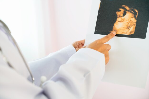 Doctor mirando foto ultra sonido en el hospital