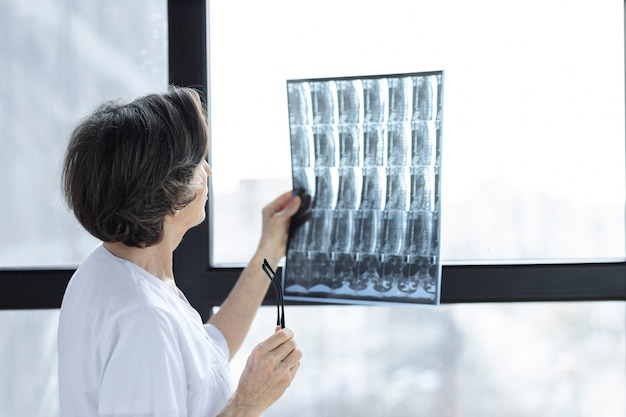 Doctor mujer de pie junto a la ventana examinando la película de rayos x de la columna del paciente en el hospital