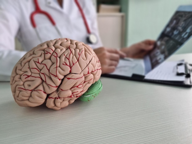 El doctor neurocirujano examina la radiografía del cerebro en la clínica