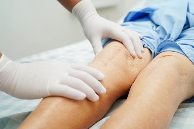 Doctor revisando a una anciana asiática con cirugía de reemplazo de rodilla con cicatriz en el hospital