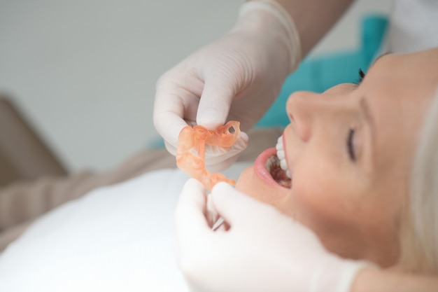 Doctor sosteniendo una prótesis dental y preparándose para ponerla en la boca del paciente