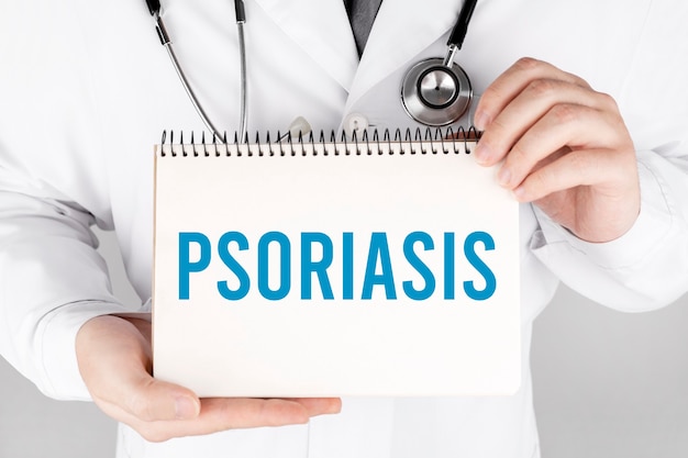 Doctor sosteniendo una tarjeta con psoriasis, concepto médico