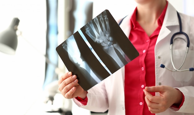 Doctora con imagen de rayos X de hueso de la mano derecha