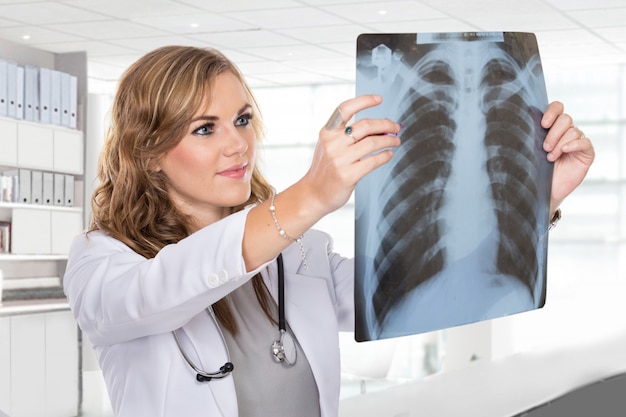 Doctora mirando una radiografía de pulmones