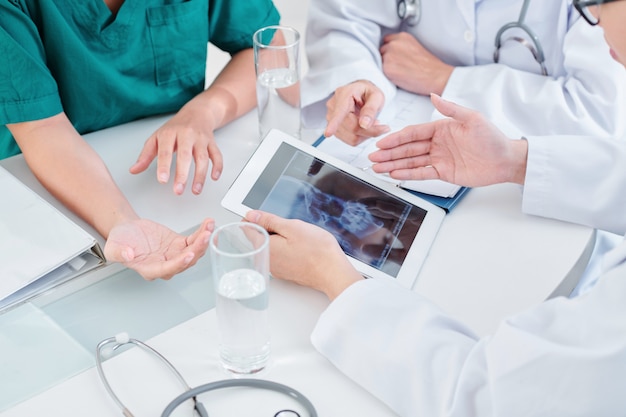 Doctores discutiendo radiografía de mandíbula